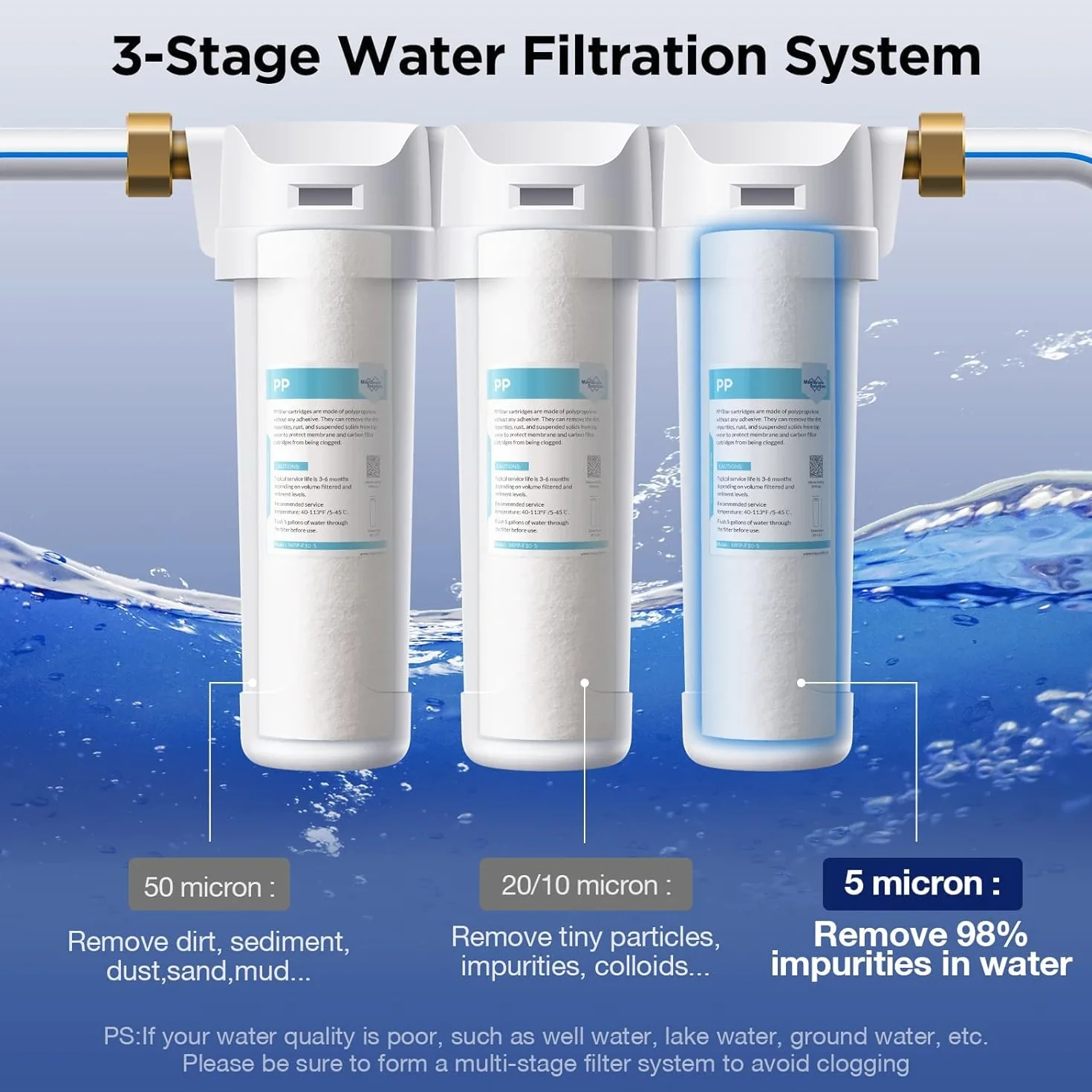 Membrane Solutions Cartucho de Sedimentos 5 Micras 10" x 2.5" Filtro de Agua Ósmosis Inversa 6 Pack
